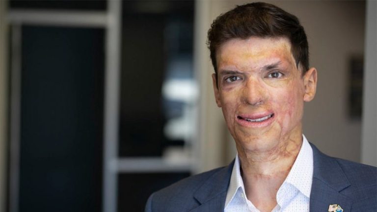 Wounded US Army vet Sam Brown targets vulnerable Nevada Democrat with fresh Senate bid: ‘Out of touch’